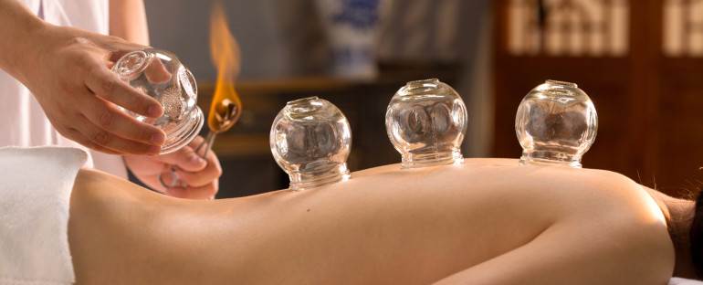 Cupping, Hijama Wet Cupping and Gua Sha