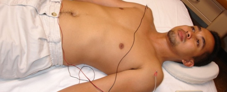 Electro Acupuncture