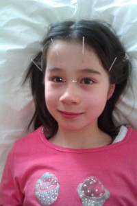 Child Acupuncture