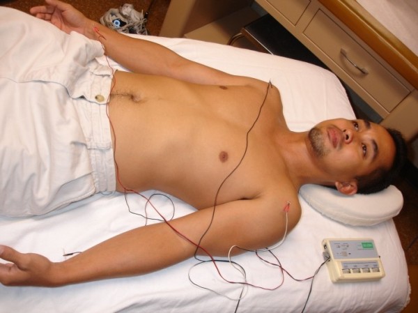 Electro Acupuncture